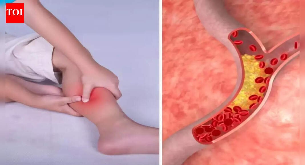 High cholesterol symptoms in legs at night: Pain, numbness, swelling, and other warning signs you should never ignore |