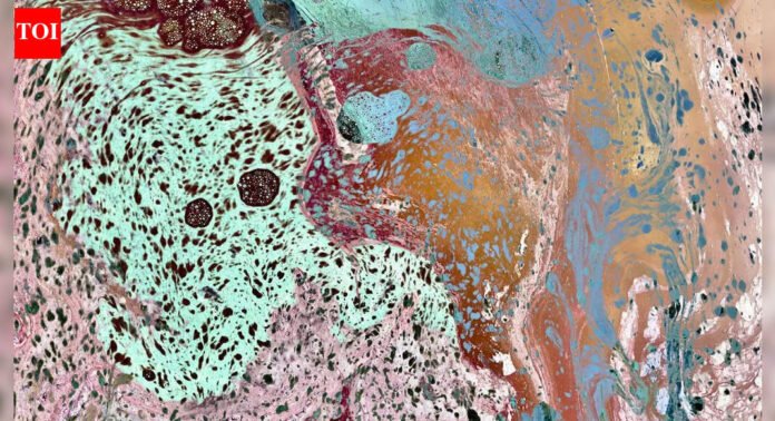 Salt Lines: A forgotten 4,000-km 'living border' reappears in a Mumbai museum | India News