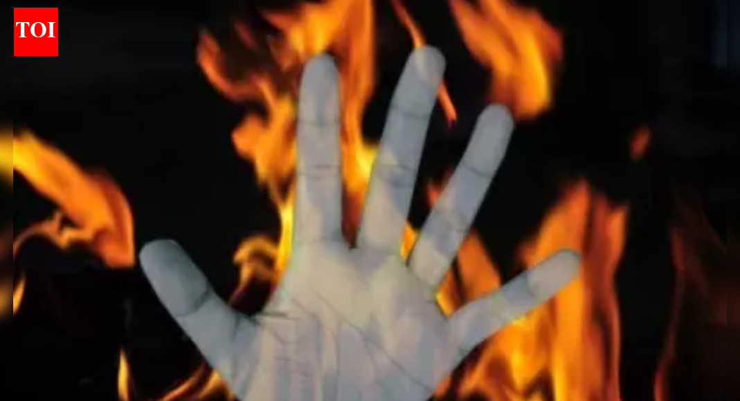 19-year-old set afire in front of college | India News