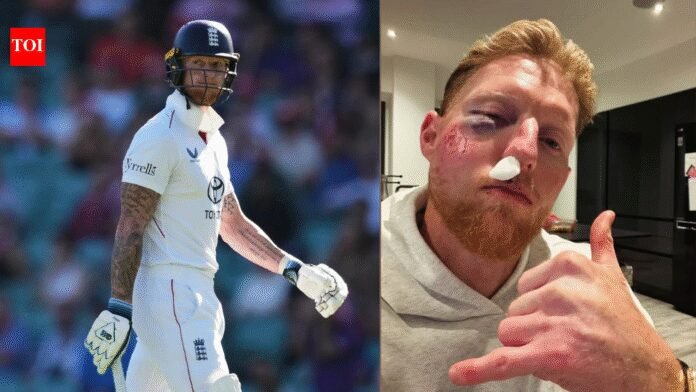 England Test captain Ben Stokes left bloodied after brutal facial injury | Cricket News
