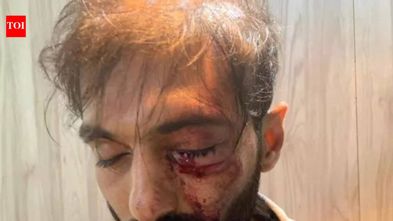 Mumbai railway police arrest labourer for throwing stone at train after man loses eye | Mumbai News