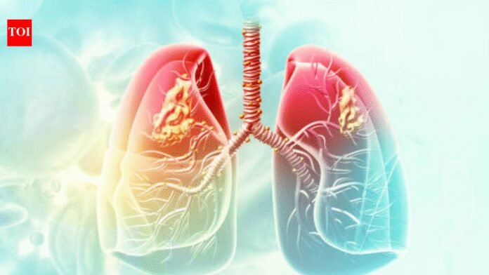 AIIMS-Delhi to study link between lung cancer and air pollution | India News