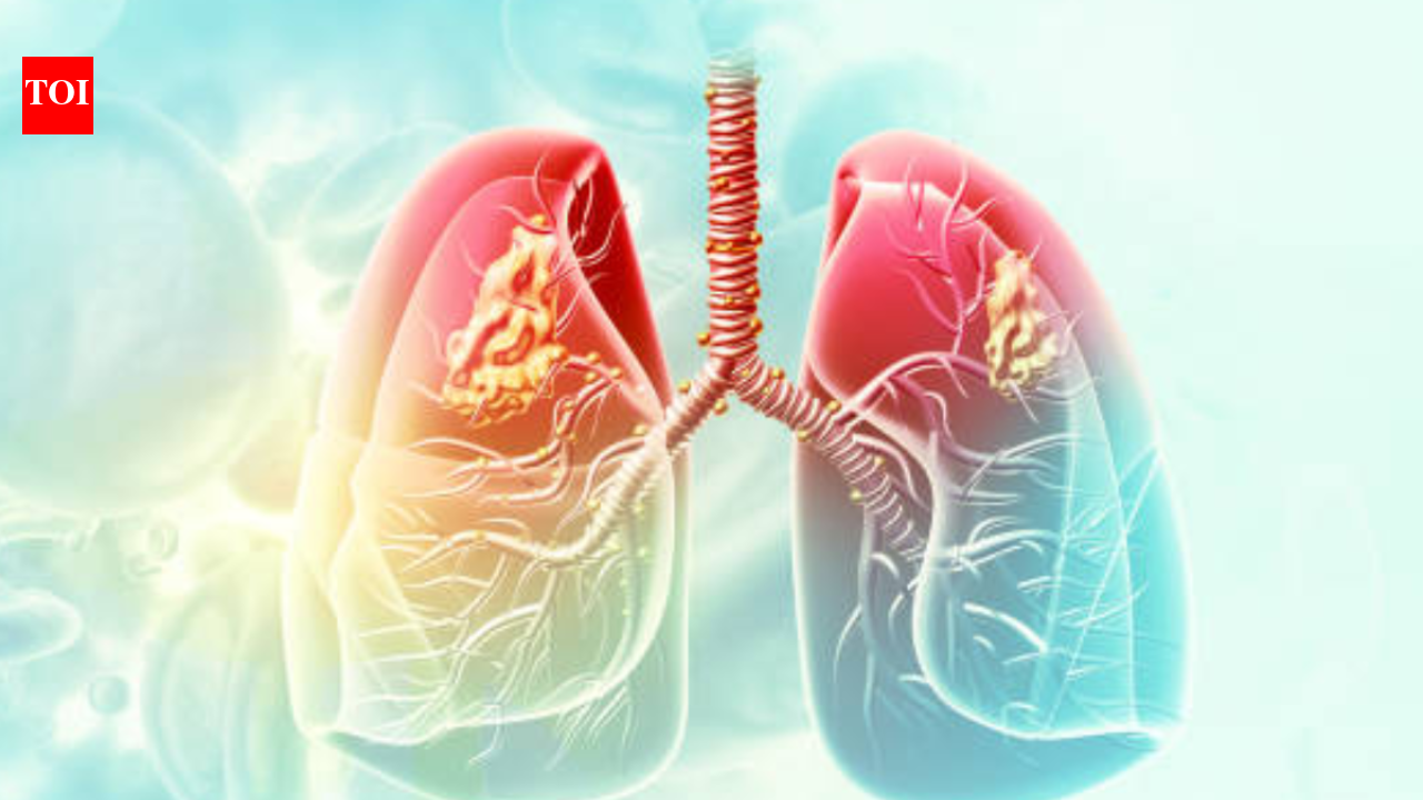 AIIMS-Delhi to study link between lung cancer and air pollution | India News