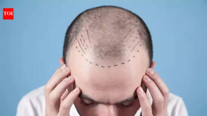Days after TN order, doctors seek similar rules nationwide as hair transplant boom raises safety alarm | India News