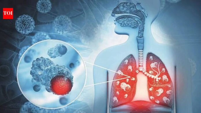 Multi-drug resistant TB cases down 28% in 3 yrs, frontline workers say testing low | Mumbai News