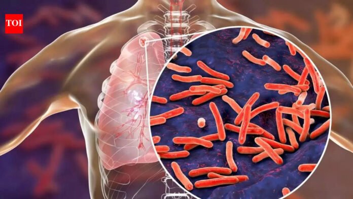 TB remains India’s biggest infectious killer, but mass screening push shows results | India News