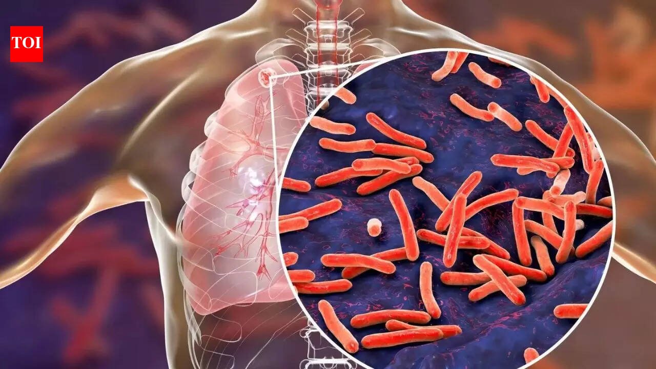 TB remains India’s biggest infectious killer, but mass screening push shows results | India News